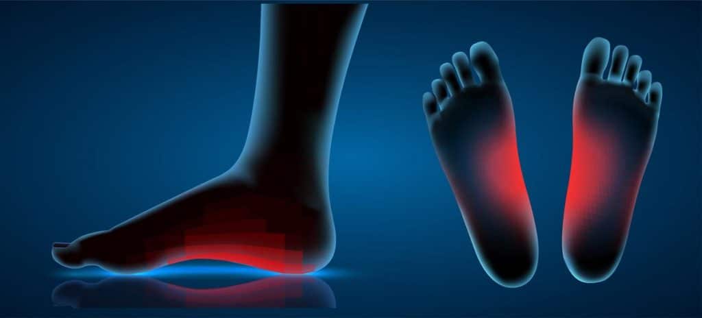je ne supporte pas les semelles orthopédiques