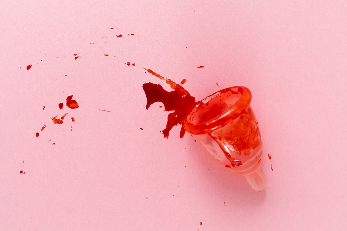 cycle menstruel irregulier que faire