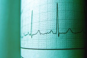 frequence cardiaque maximale calcul
