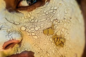 peau seche du visage que faire